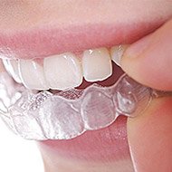 treatment clear aligners thumb