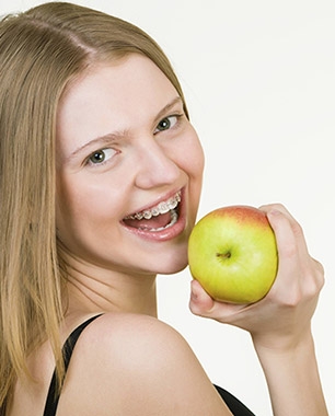Life with Braces img about life with braces