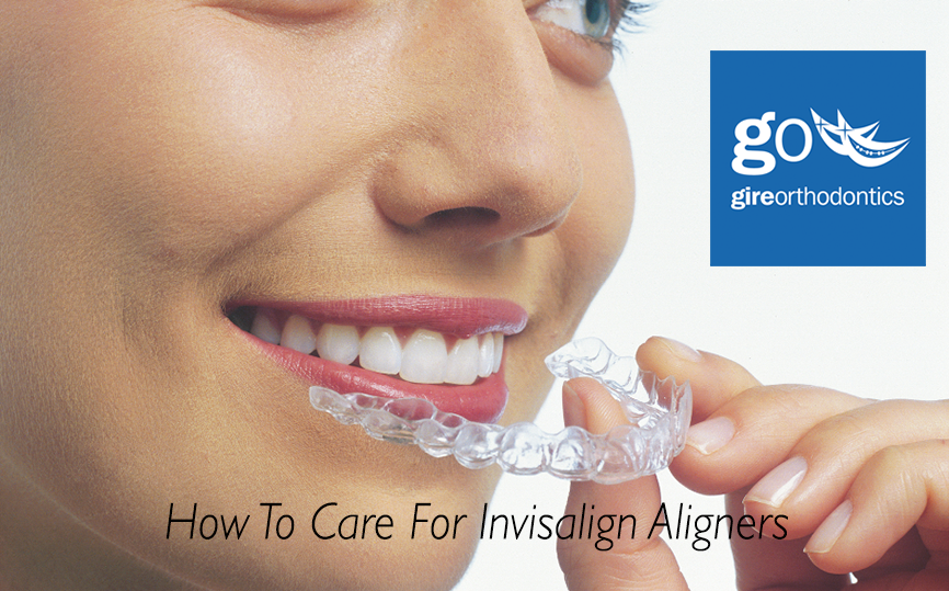 invisalign aligners