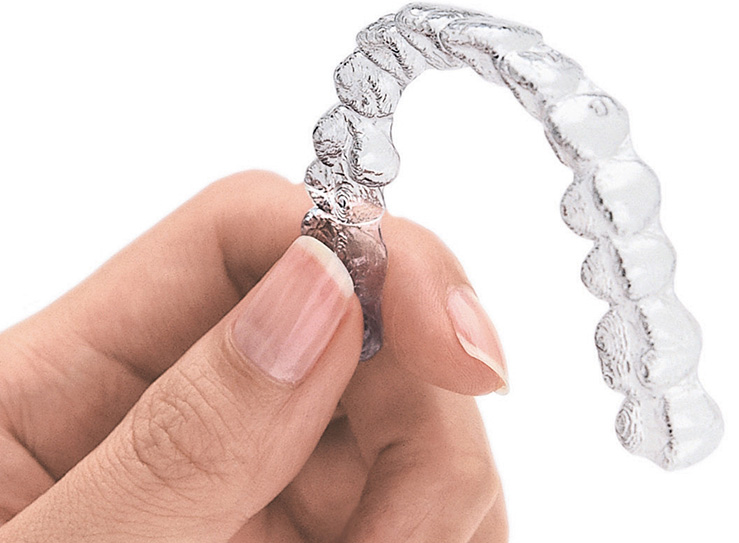 invisalign clear aligners