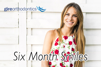 Six Month Smiles