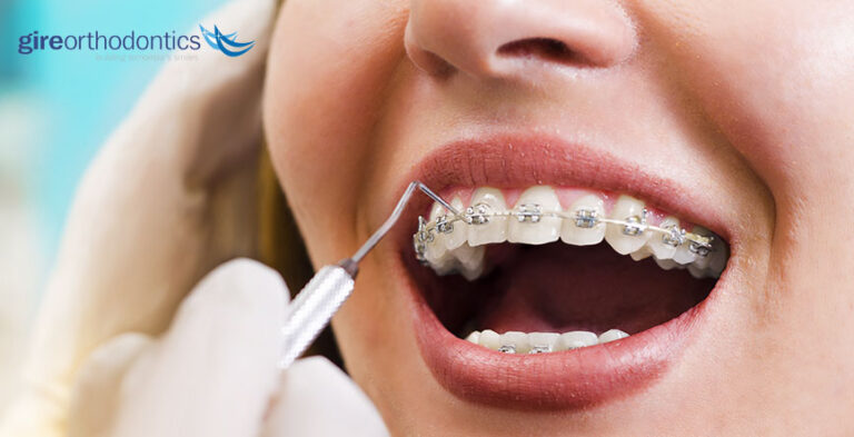 How to Find the Right Orthodontist