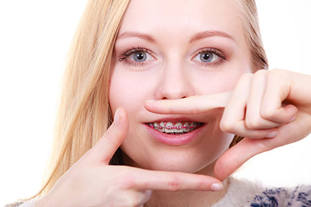 Orthodontist Second Opinion