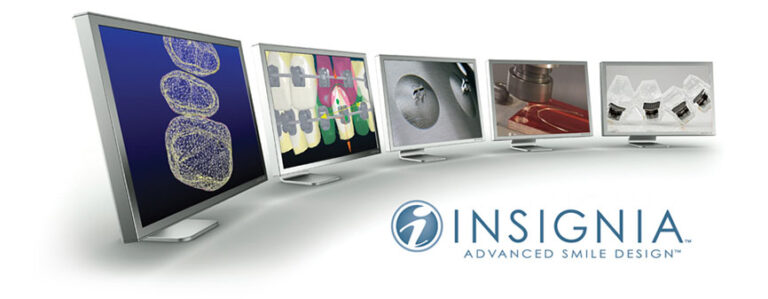 What Are Insignia Braces?