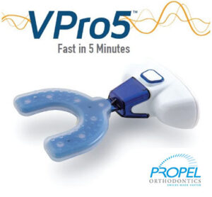 Vpro5 Accelerated Orthodontics: AcceleDent & Propel VPro5 - Gire Orthodontics