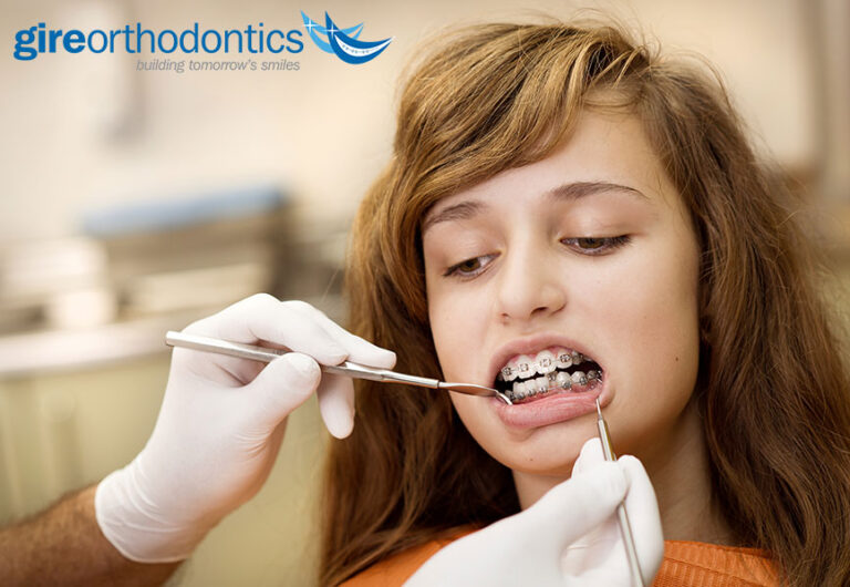 Visiting the Dentist While in Orthodontic Treatment