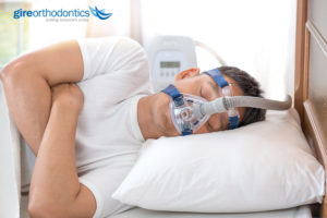 sleep apnea 300x200