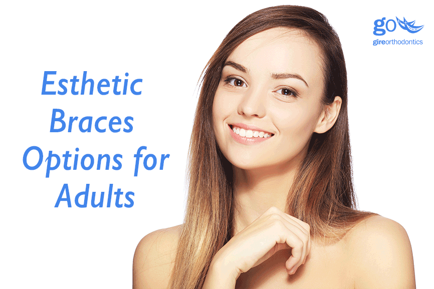 Esthetic Braces Adults