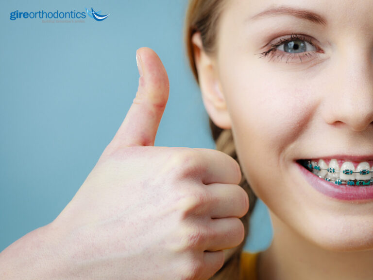 How To Ensure You and Your Braces Have a Good Relationship