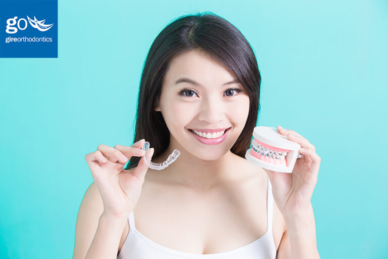 Orthodontic Options for Teens