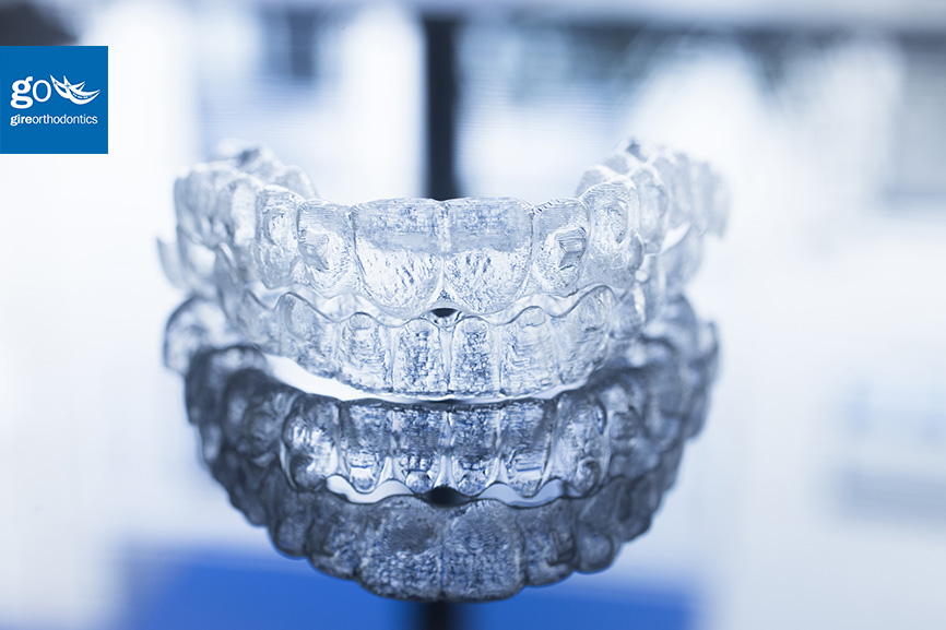 Invisalign Difference