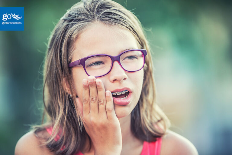 Tips to Relieve Braces Discomfort