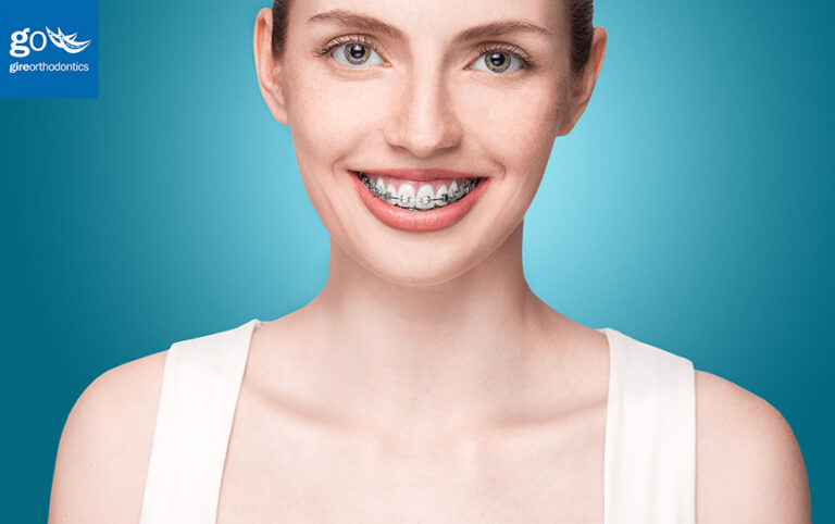 How much do braces and Invisalign cost in La Habra and Chino Hills?
