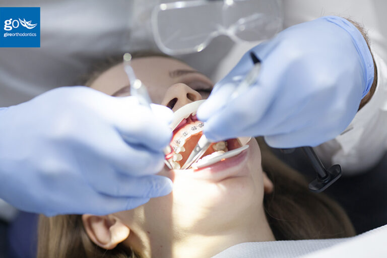 What is Surgical Orthodontics?