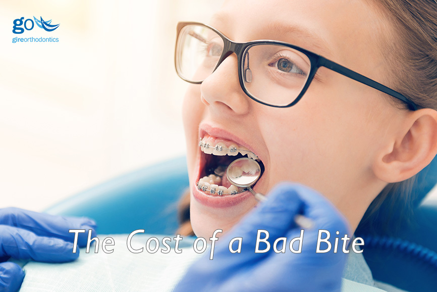 cost of bad bite