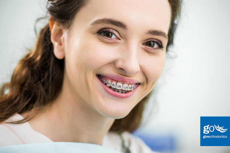 How Have Braces Changed Over the Years?