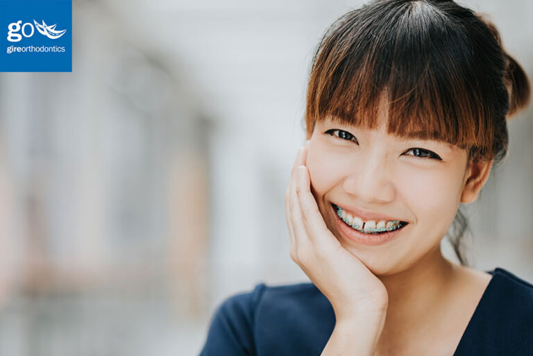 Answers to Your Teens Most Frequently Asked Orthodontic Questions