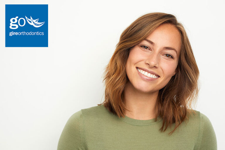 What are Spark Aligners?