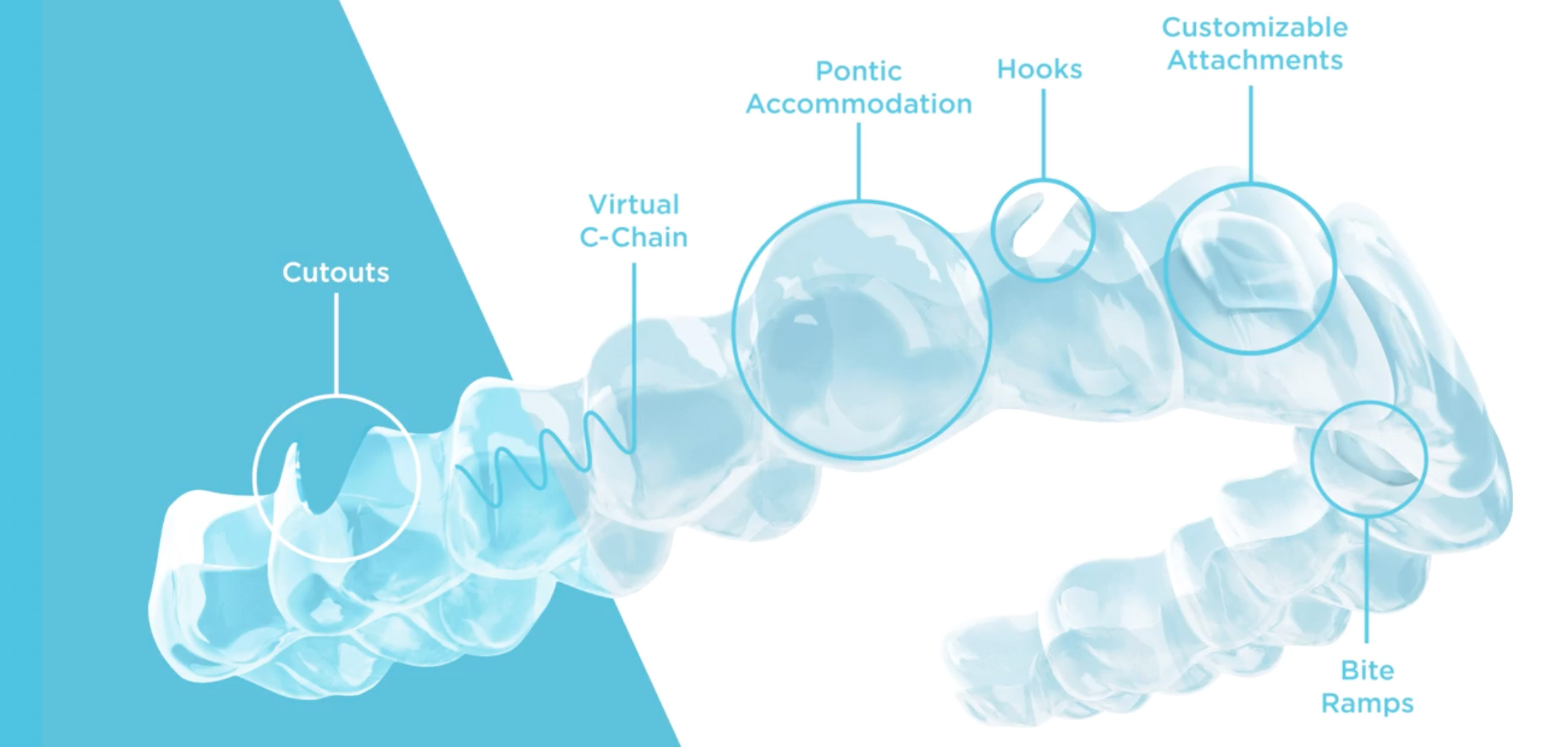 spark clear aligners