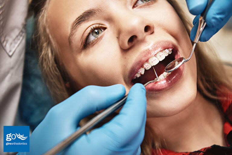 What Happens if I Need Dental Work During Orthodontic Treatment?