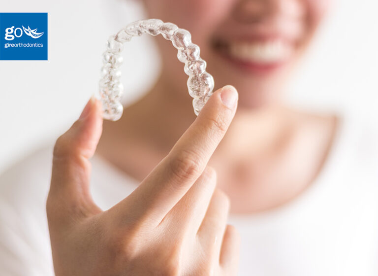 Can Spark or Invisalign Clear Aligners Correct an Overbite?