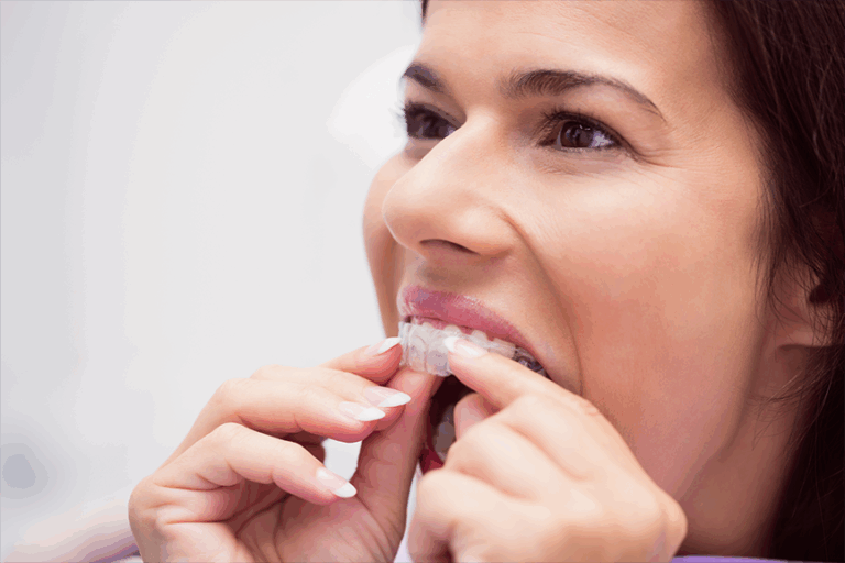 Can’t My Dentist Provide My Orthodontic Treatment?