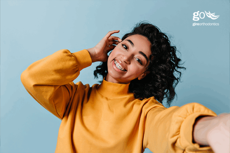 Will Braces Change My Facial Appearance?