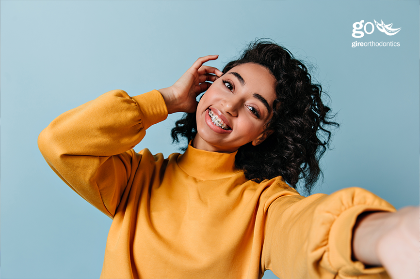 Will Braces Change My Facial Appearance? Orthodontic Treatment Can Affect Face Shape