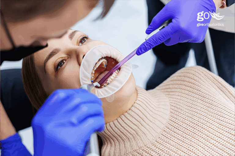 Why Do Orthodontists Charge Different Prices for Treatment?
