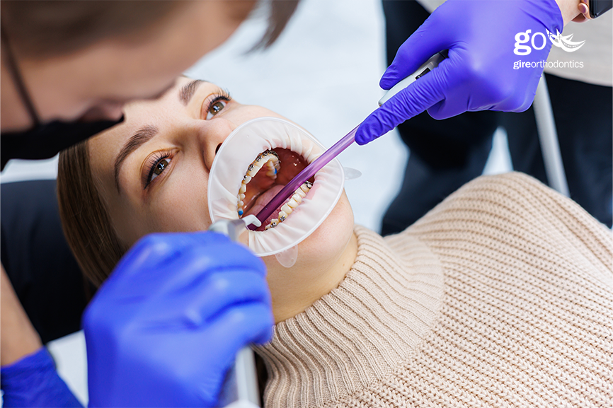 Orthodontic Treatment Costs