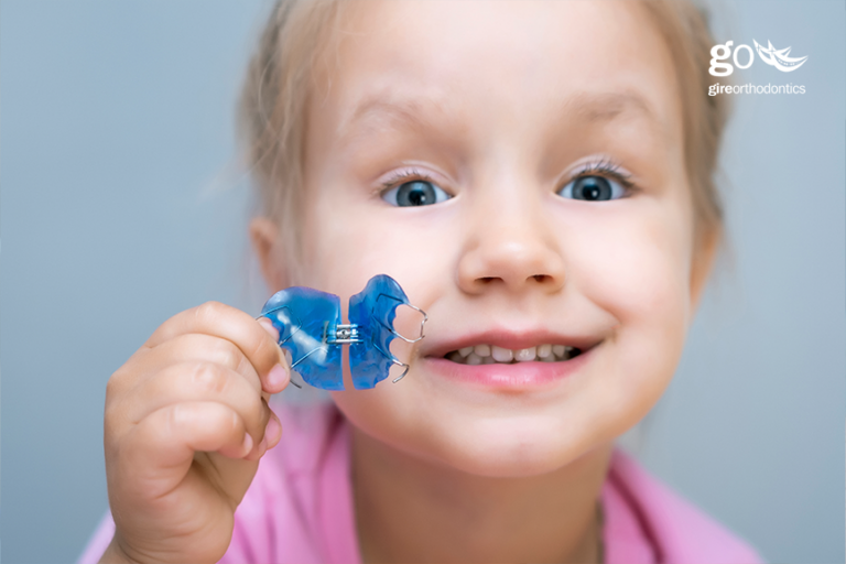 What Are The Phases of Orthodontic Treatment? Chino Hills, La Habra CA