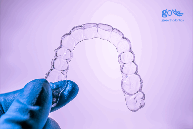 Oh No – My Clear Aligners Aren’t Tracking!