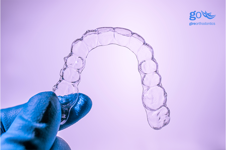 clear aligners not tracking