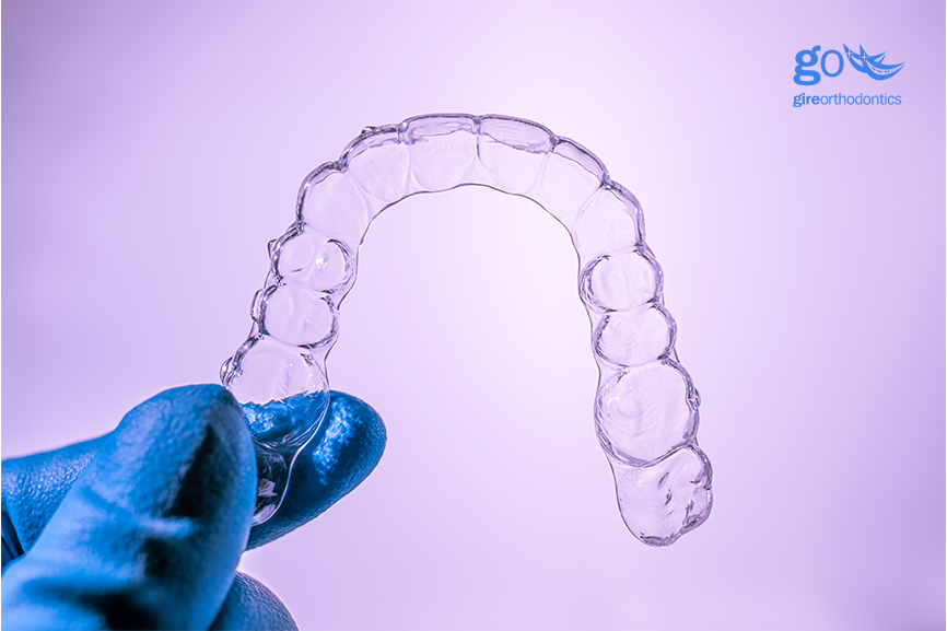 Oh No – My Clear Aligners Aren’t Tracking! clear aligners not tracking
