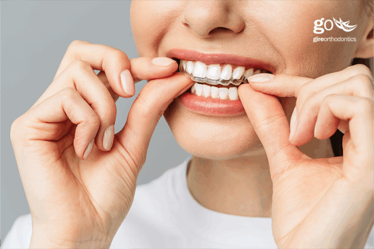 Technological Advances Improve Orthodontic Care￼