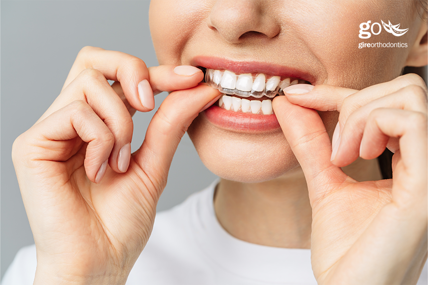 Technological Advances Improve Orthodontic Care orthodontics latest technologies