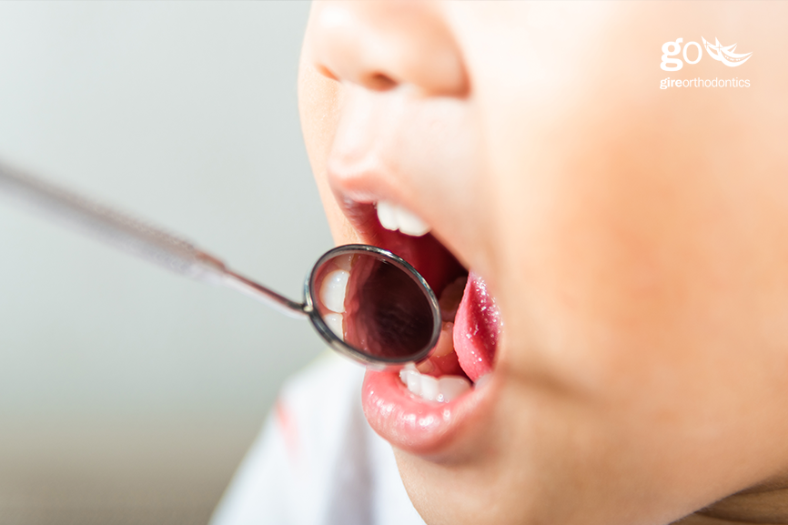 What is Pediatric Orthodontics?