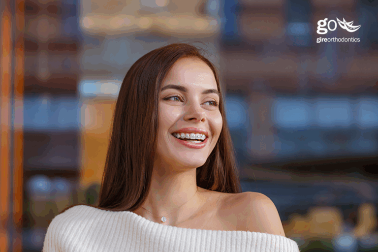 Do I Need Braces as an Adult?