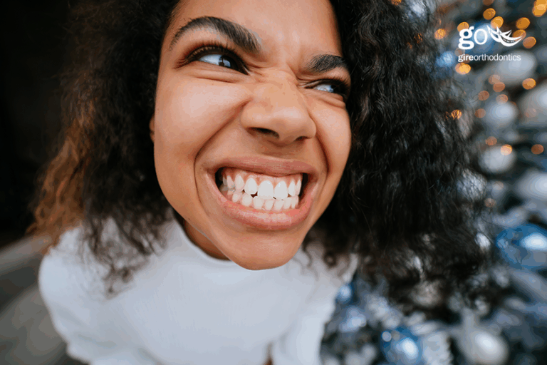 Do I Need Braces Again?