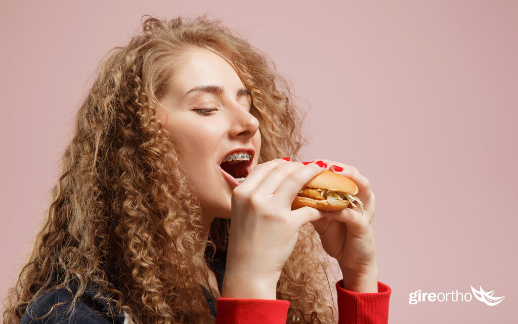 Eating with Braces: The Ultimate Guide + 4 Incredible Braces-Friendly Recipes from Dr. Gire