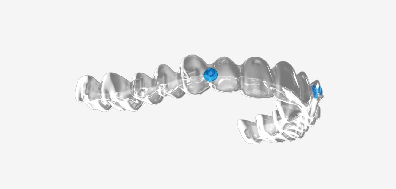 Angel Aligners