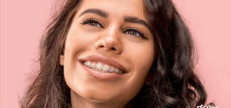 Can I Make Payments on My Braces?