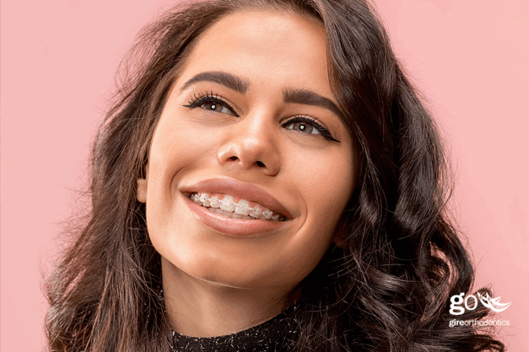 Can I Make Payments on My Braces?