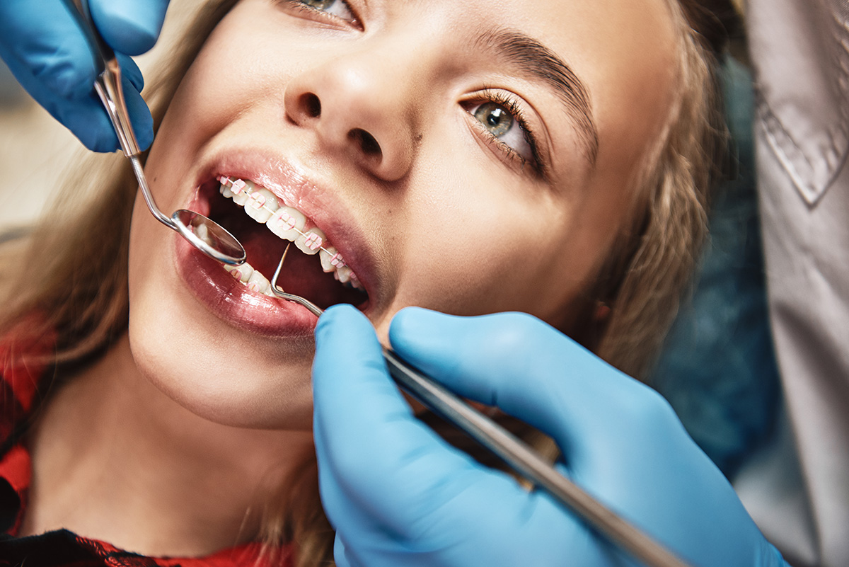 Top Orthodontic Care