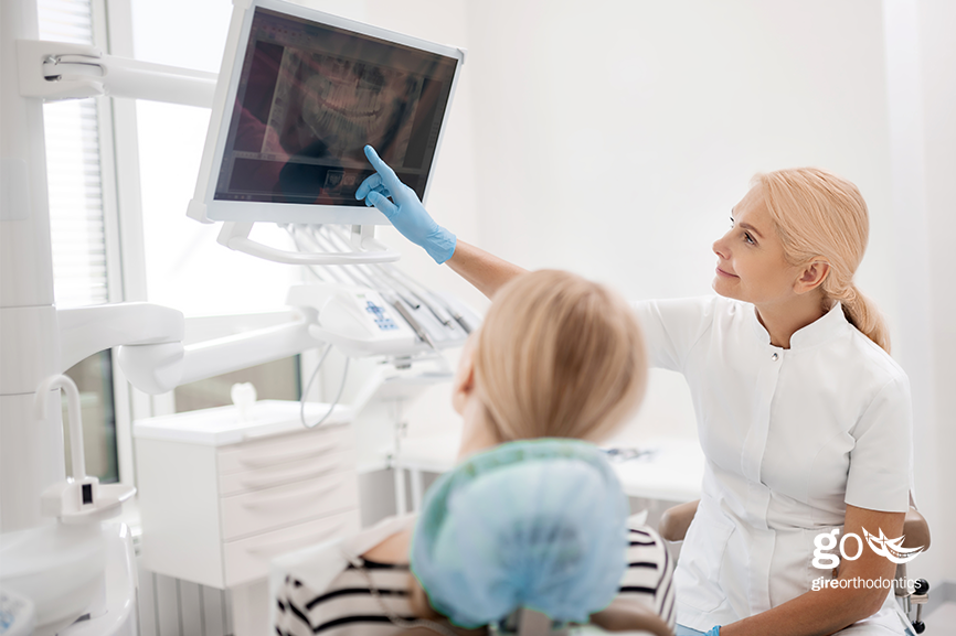 Do I Need a Referral to Start Orthodontic Treatment?