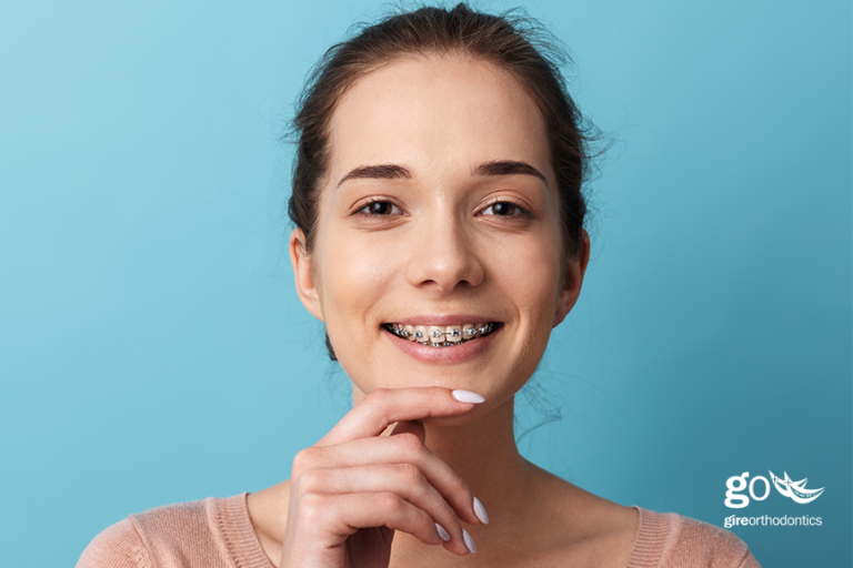The Rising Demand for Straighter Teeth in Adulthood