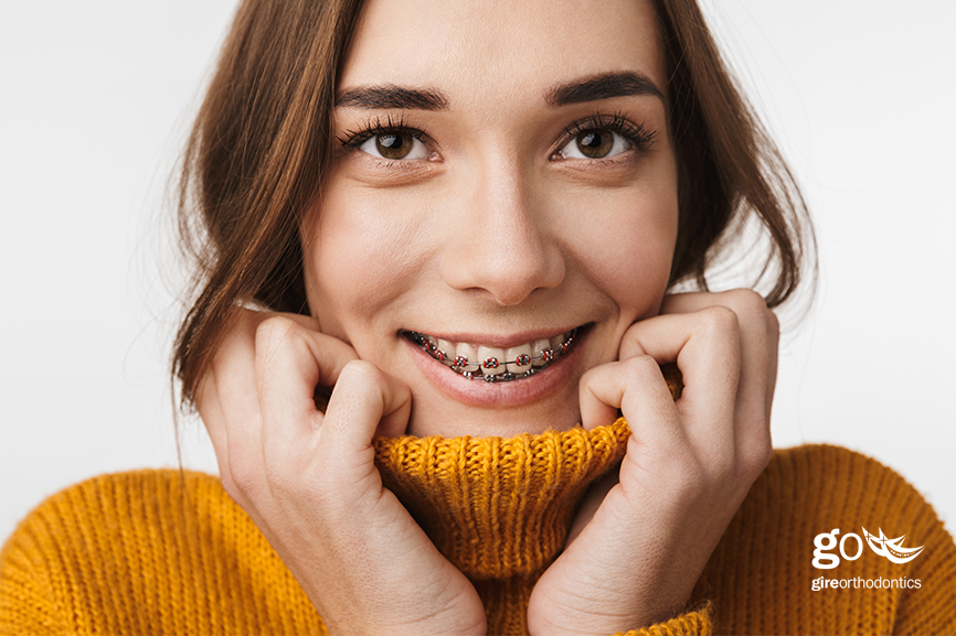 Can You Get Both Top and Bottom Braces at the Same Time?