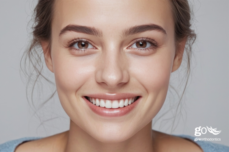 Veneers or Braces: Which Is Best for a Straight Smile?